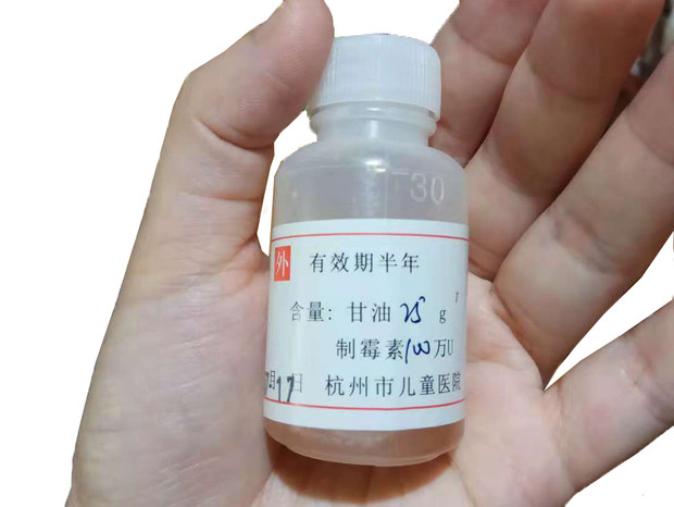 寶寶嘴里長(zhǎng)了白色斑點(diǎn)，很可能是鵝口瘡